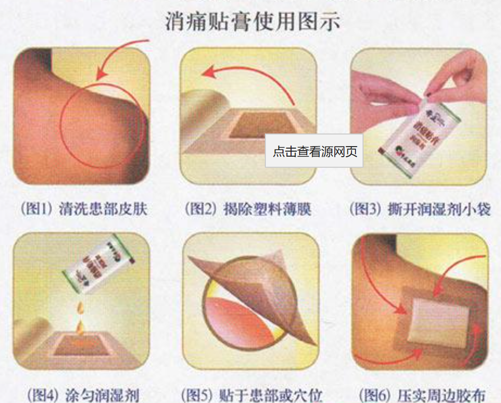 如何正确使用奇正消痛贴膏呢?