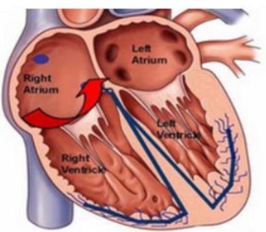 心肌缺血和脑供血不足怎么办，如何治疗呢？