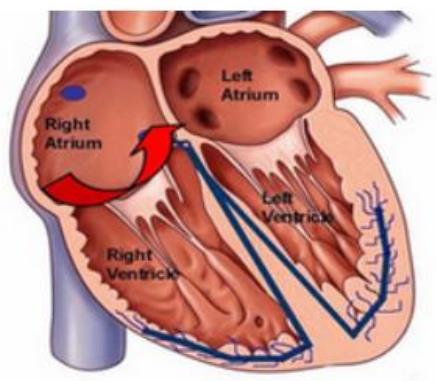 中风的急救措施，这些急救措施你知道吗