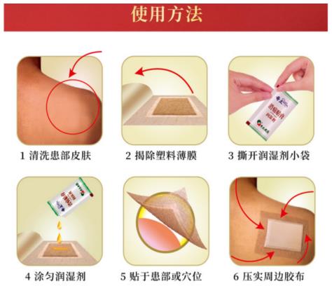 奇正消痛贴膏可以治手腕扭伤吗？