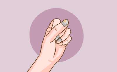 轻微灰指甲的治疗方法有什么？