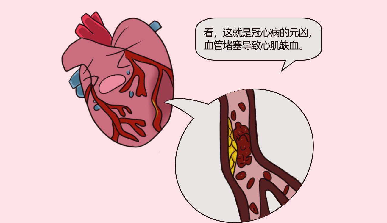 冠心病是由什么原因引起的？如何治疗冠心病