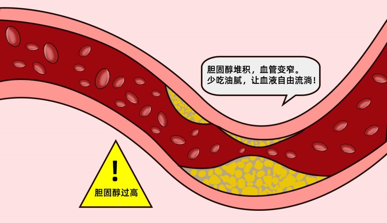 老年冠心病吃什么药