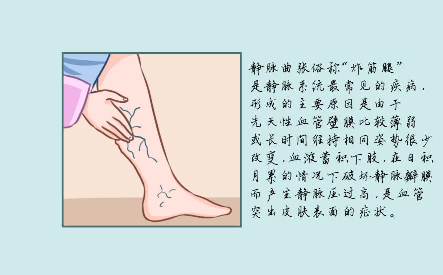 医用弹力袜整天都要穿吗