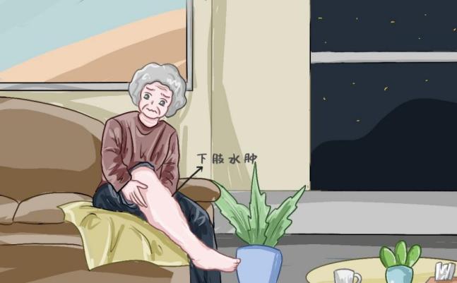 引起慢性心衰的诱发因素有哪些