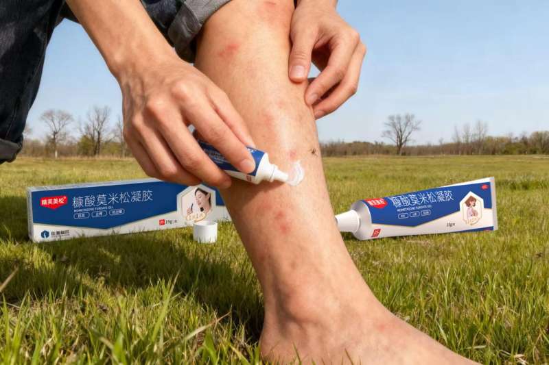 虫咬性皮炎怎么办？