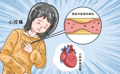 小雪至寒邪生，心绞痛突发怎么救？常备救心丸护心过寒冬