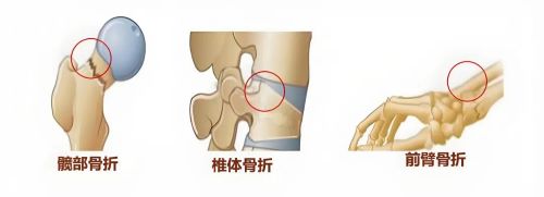 科学补钙要趁早！用励全碳酸钙D3片，为骨骼做一份终身“投资”