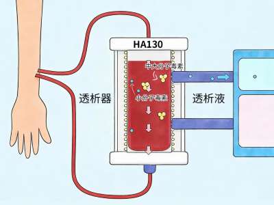 血液灌流适应什么症状?尿毒症患者出现这些情况可以考虑