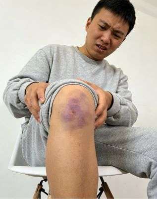 伤科灵喷雾剂可以止痛吗?