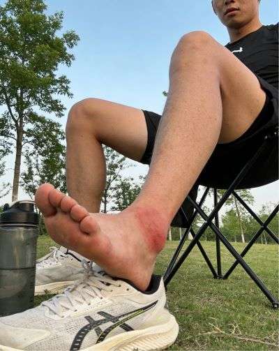 伤科灵有什么用?