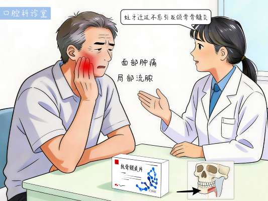 用药科普：颌骨骨髓炎哪些品牌的药好用？